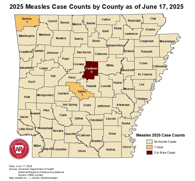 Measles Case Count